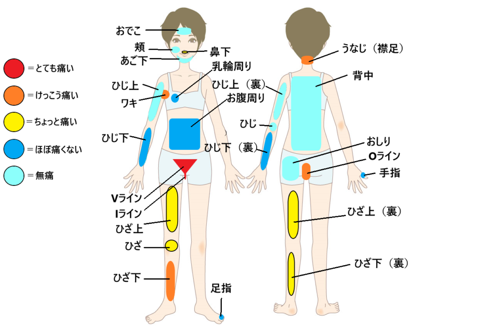 女性全身脱毛の痛さ比較表