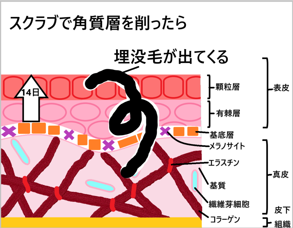 ②スクラブで角質層を削った画像