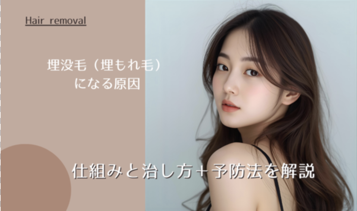 【イラスト付き】埋没毛（埋もれ毛）になる原因と仕組みと治し方＋予防法